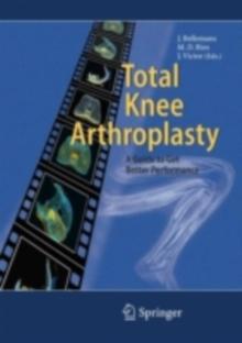 Total Knee Arthroplasty : A Guide to Get Better Performance