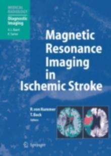 Magnetic Resonance Imaging in Ischemic Stroke