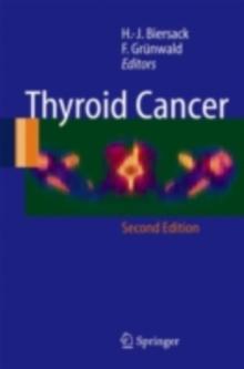 Thyroid Cancer