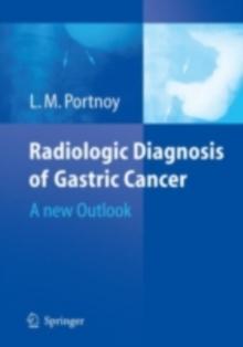 Radiologic Diagnosis of Gastric Cancer : A new Outlook