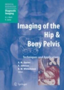 Imaging of the Hip & Bony Pelvis : Techniques and Applications