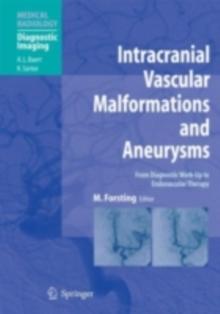 Intracranial Vascular Malformations and Aneurysms : From Diagnostic Work-Up to Endovascular Therapy