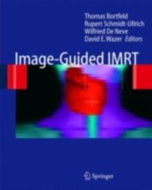 Image-Guided IMRT