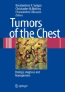 Tumors of the Chest : Biology, Diagnosis and Management