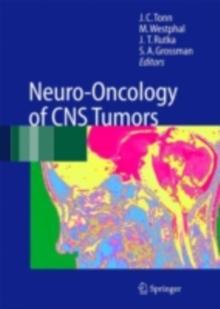 Neuro-Oncology of CNS Tumors