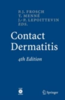 Contact Dermatitis