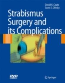 Strabismus Surgery and its Complications