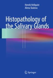 Histopathology of the Salivary Glands