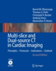 Multi-slice and Dual-source CT in Cardiac Imaging : Principles - Protocols - Indications - Outlook