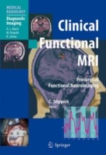 Clinical Functional MRI : Presurgical Functional Neuroimaging