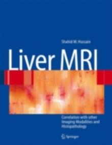 Liver MRI : Correlation with other Imaging Modalities and Histopathology