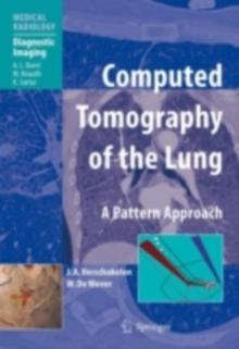 Computed Tomography of the Lung : A Pattern Approach