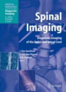 Spinal Imaging : Diagnostic Imaging of the Spine and Spinal Cord