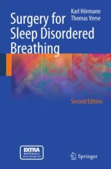 Surgery for Sleep Disordered Breathing