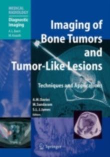 Imaging of Bone Tumors and Tumor-Like Lesions : Techniques and Applications