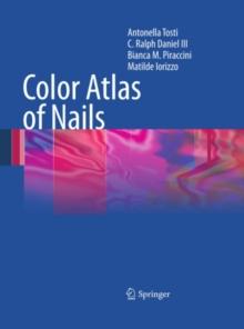 Color Atlas of Nails