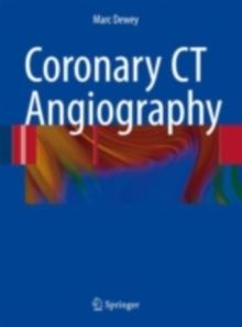 Coronary CT Angiography