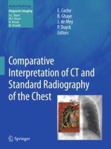 Comparative Interpretation of CT and Standard Radiography of the Chest