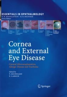 Cornea and External Eye Disease : Corneal Allotransplantation, Allergic Disease and Trachoma