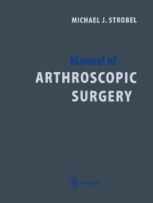 Manual of Arthroscopic Surgery