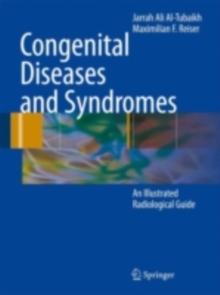 Congenital Diseases and Syndromes : An Illustrated Radiological Guide