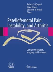 Patellofemoral Pain, Instability, and Arthritis : Clinical Presentation, Imaging, and Treatment