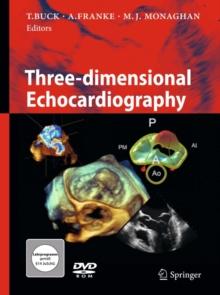 Three-dimensional Echocardiography