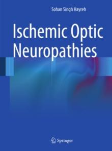 Ischemic Optic Neuropathies