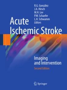 Acute Ischemic Stroke : Imaging and Intervention