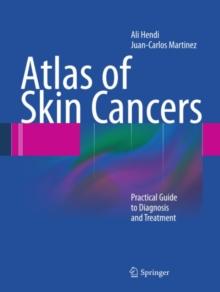 Atlas of Skin Cancers : Practical Guide to Diagnosis and Treatment