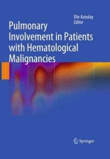 Pulmonary Involvement in Patients with Hematological Malignancies