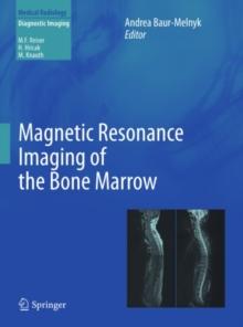 Magnetic Resonance Imaging of the Bone Marrow