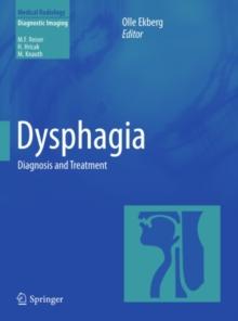 Dysphagia : Diagnosis and Treatment