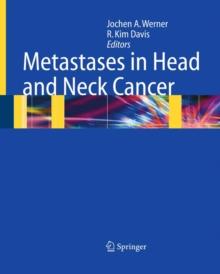 Metastases in Head and Neck Cancer