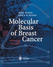 Molecular Basis of Breast Cancer : Prevention and Treatment