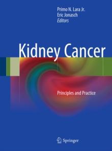 Kidney Cancer : Principles and Practice