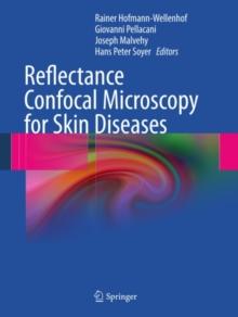 Reflectance Confocal Microscopy for Skin Diseases