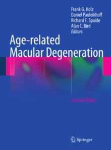 Age-related Macular Degeneration