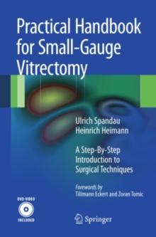 Practical Handbook for Small-Gauge Vitrectomy : A Step-By-Step Introduction to Surgical Techniques