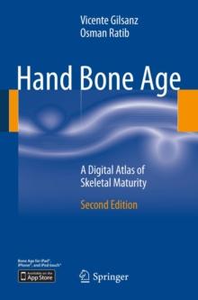 Hand Bone Age : A Digital Atlas of Skeletal Maturity