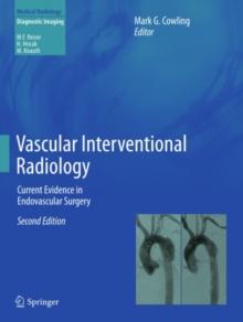 Vascular Interventional Radiology : Current Evidence in Endovascular Surgery