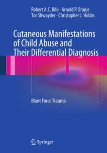 Cutaneous Manifestations of Child Abuse and Their Differential Diagnosis : Blunt Force Trauma