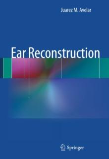 Ear Reconstruction