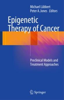 Epigenetic Therapy of Cancer : Preclinical Models and Treatment Approaches