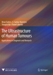 The Ultrastructure of Human Tumours : Applications in Diagnosis and Research