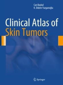 Clinical Atlas of Skin Tumors