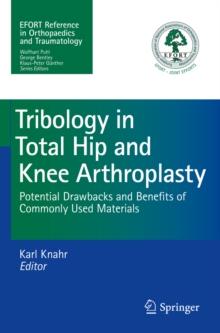 Tribology in Total Hip and Knee Arthroplasty : Potential Drawbacks and Benefits of Commonly Used Materials