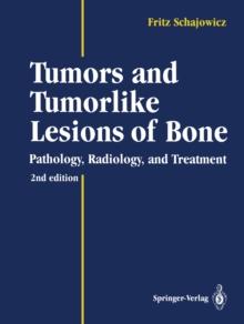 Tumors and Tumorlike Lesions of Bone : Pathology, Radiology, and Treatment