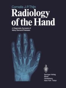 Radiology of the Hand : A Diagnostic Synopsis of Many General Diseases