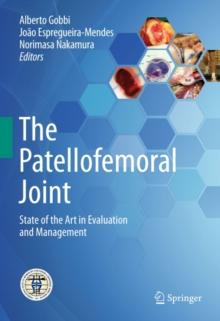 The Patellofemoral Joint : State of the Art in Evaluation and Management